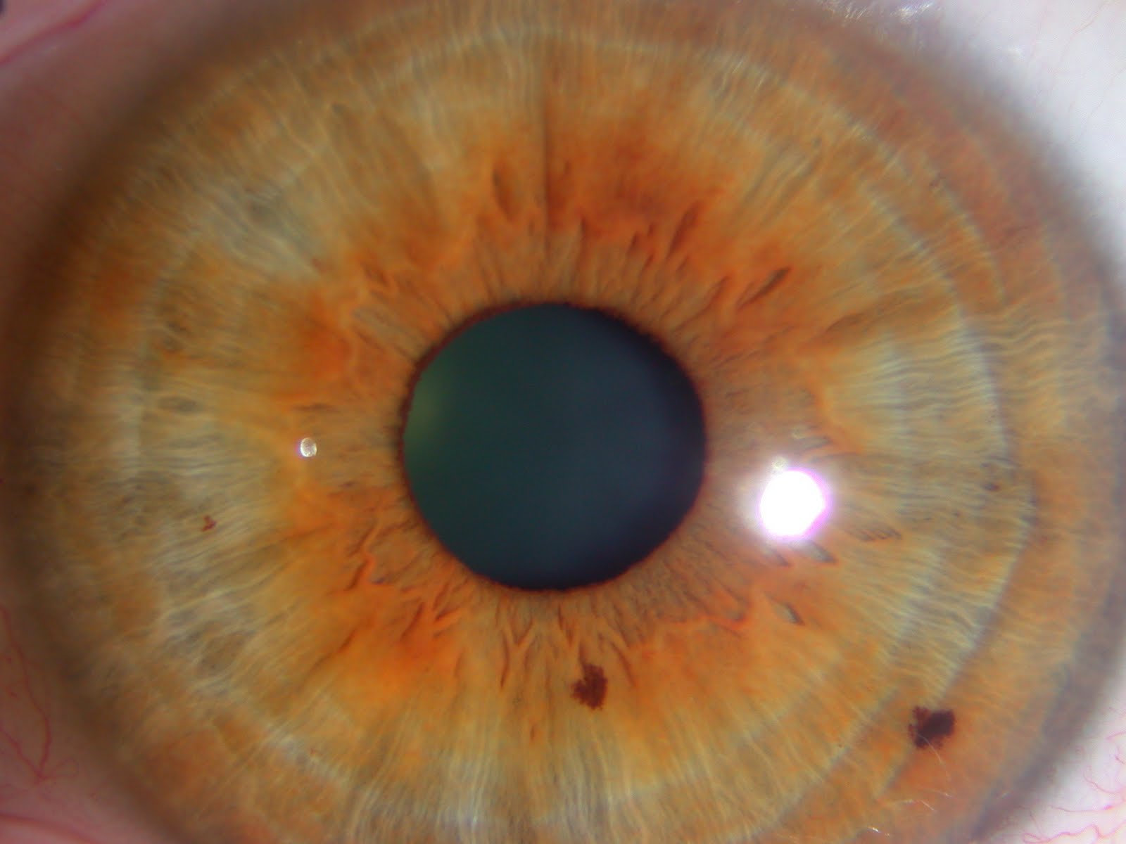 Iridology Camera for Sale (1)