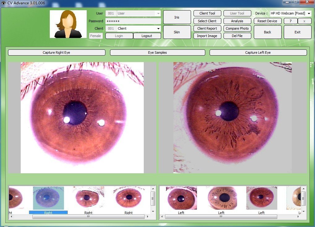 Iridology Machine for Sale