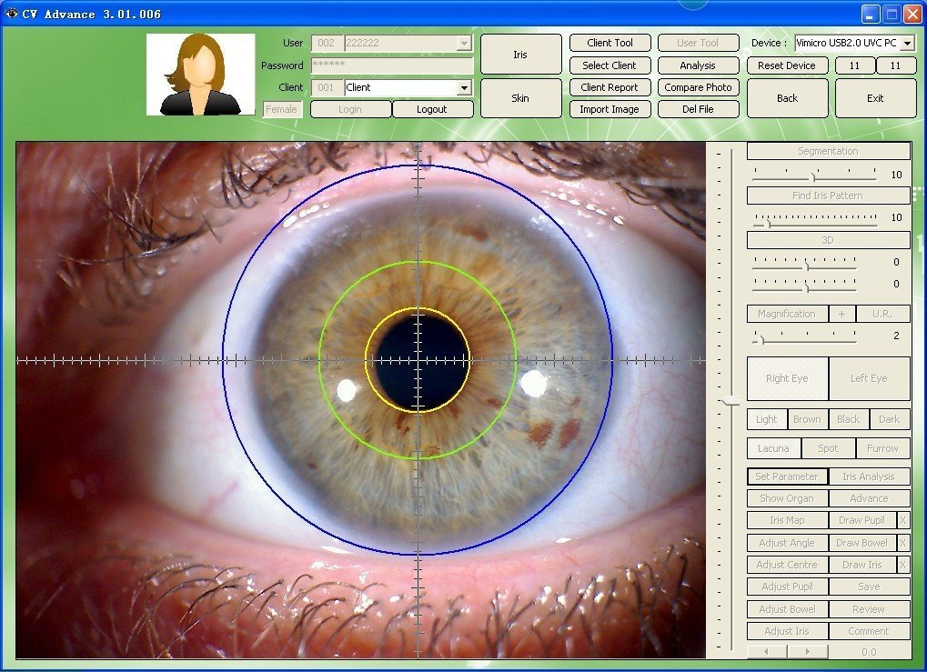 Iridology Machine for Sale