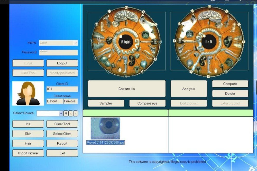 Iridology Machine for Sale