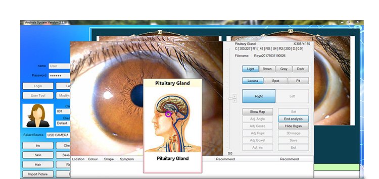 Iridology Machines