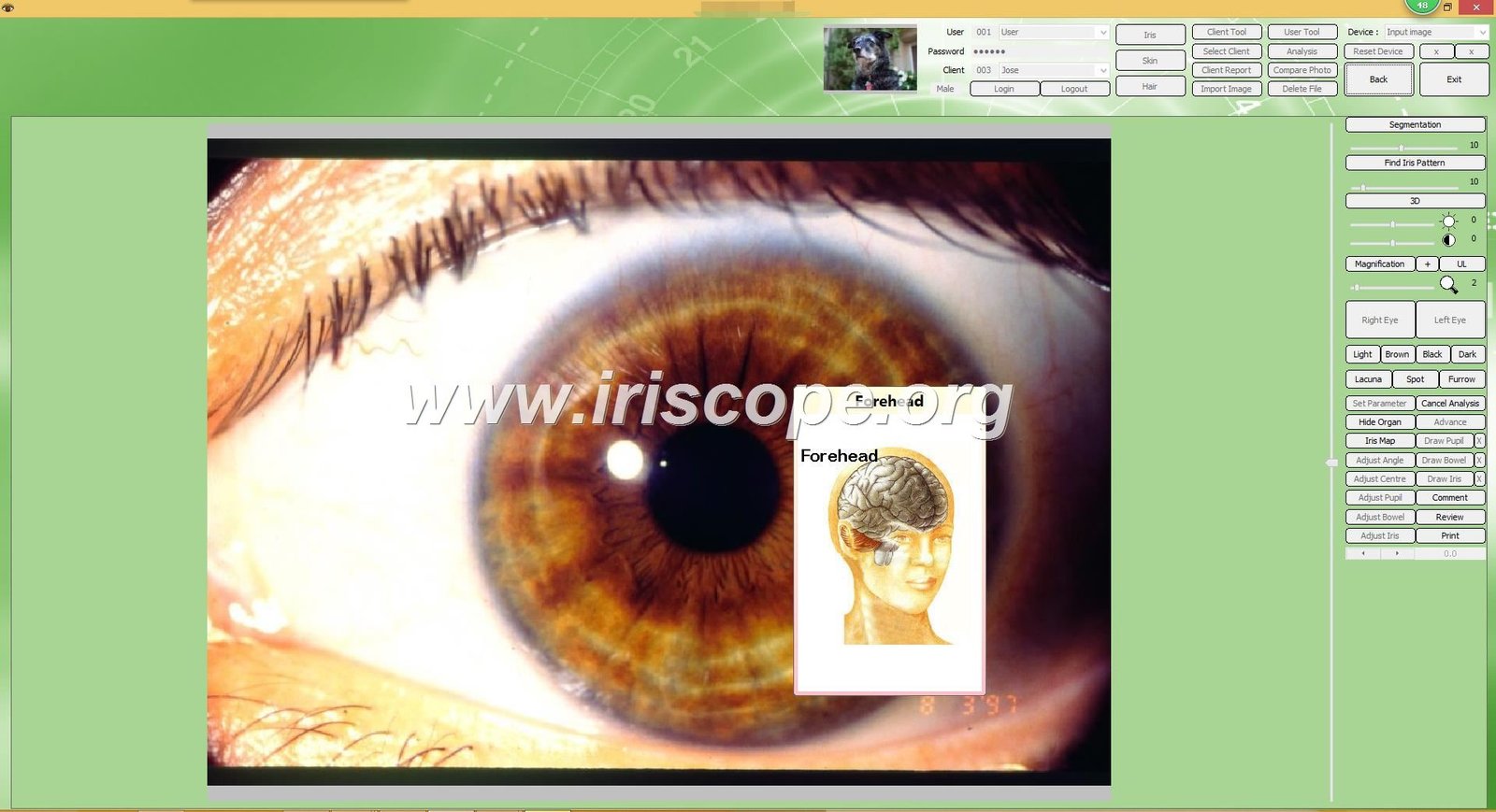 Sunshine Beeson Iridology