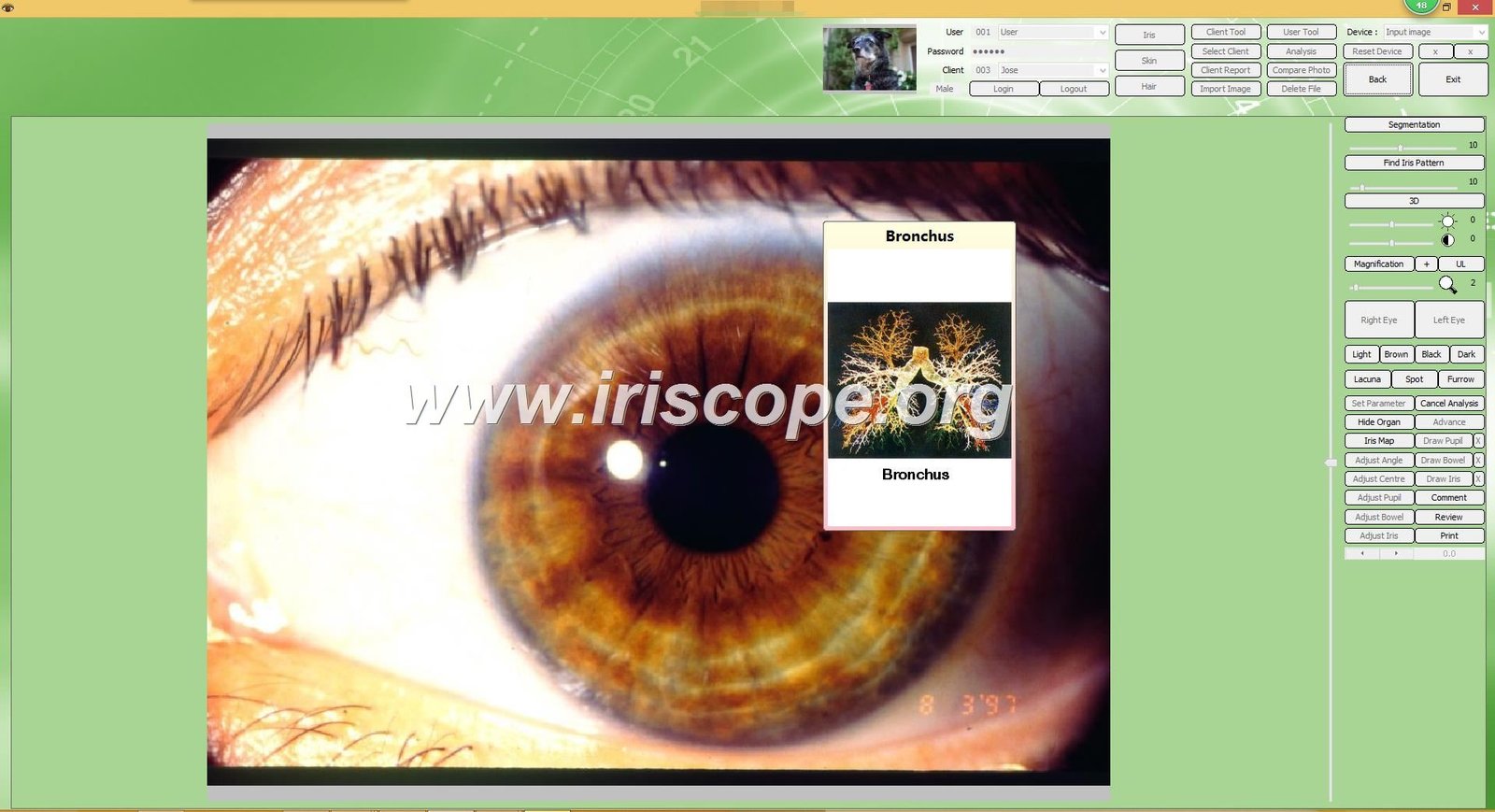 Sunshine Beeson Iridology