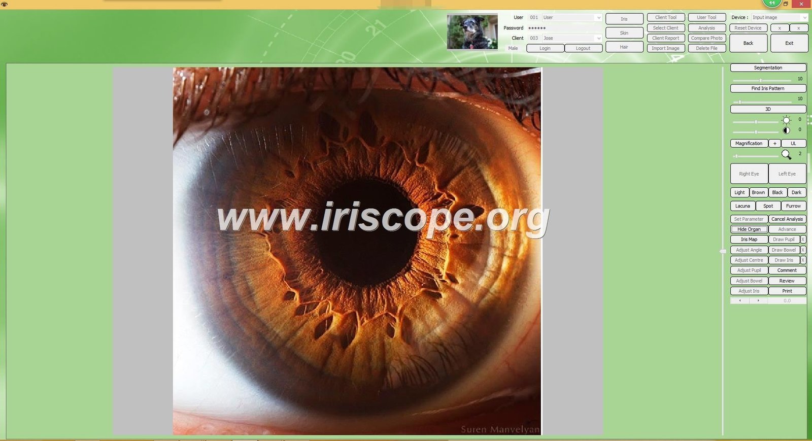 Sunshine Beeson Iridology