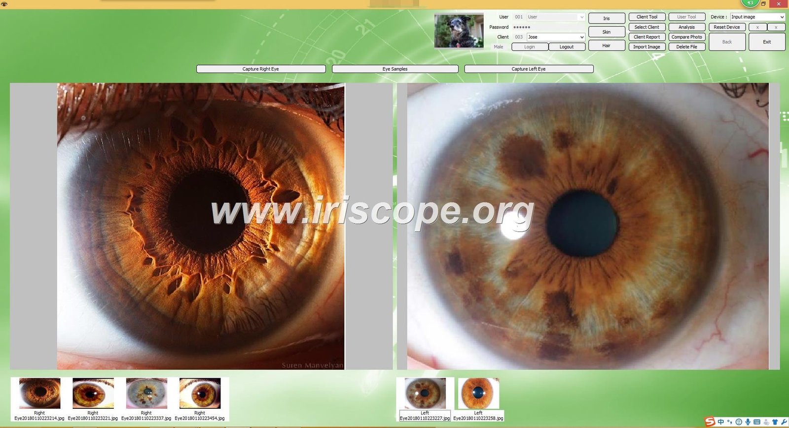 Sunshine Beeson Iridology