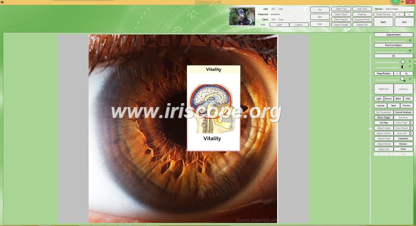 Sunshine Beeson Iridology